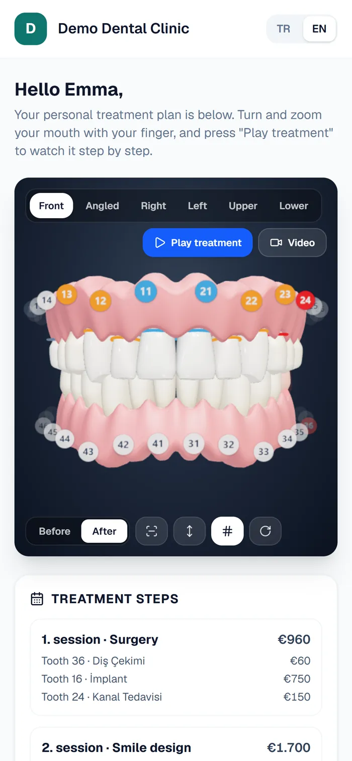 The 3D treatment plan page on a patient's phone