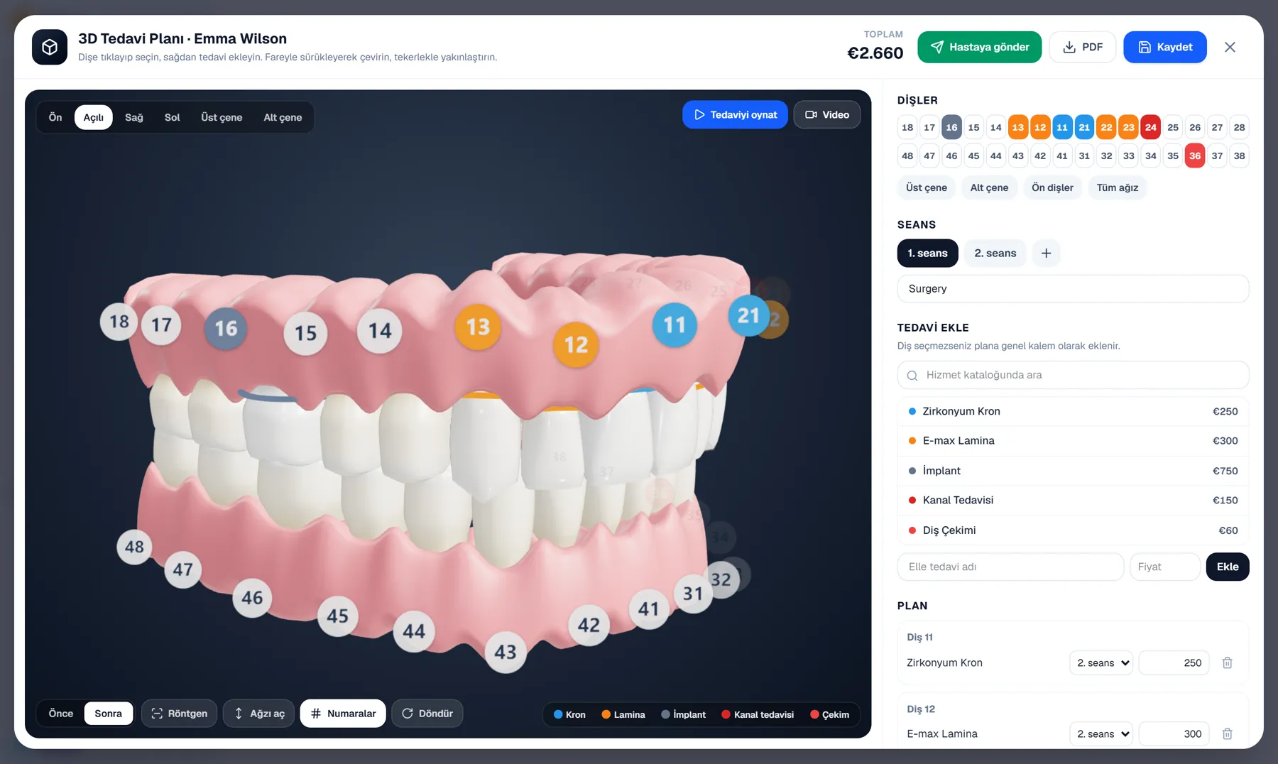 iri CRM 3D Treatment Plan Studio: 3D mouth, tooth chart, sessions and prices